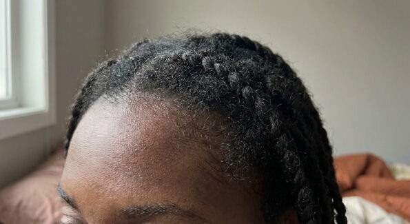 how to regrow edges naturally